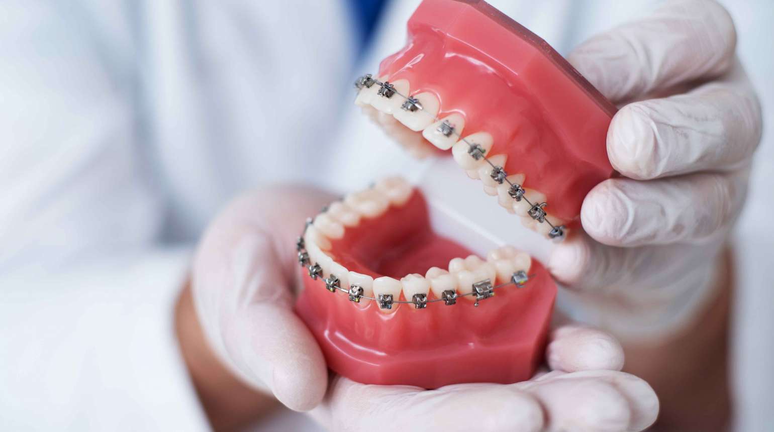 Ortodoncia y efectividad