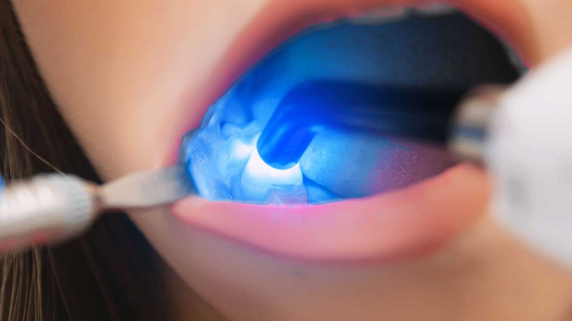 El láser en odontología